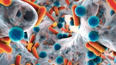 腸道菌群移植或可實現類風濕關節炎的早期預防和治療